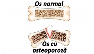 CH-Alpha® OSTEO - Peptide Bioactive de Colagen®